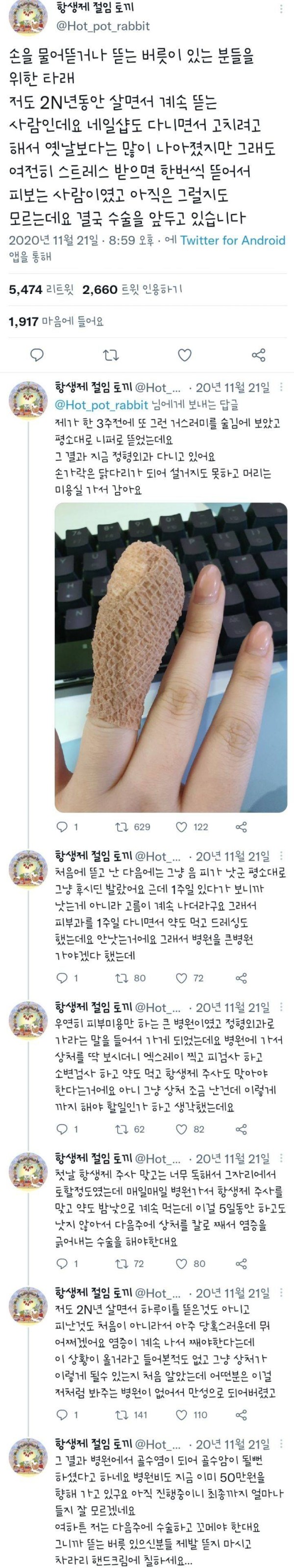 손에있는 이물질들을 그냥 뜯으면 큰일나는 이유